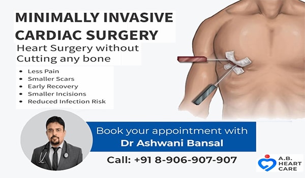 What is minimally invasive cardiac heart surgery in Chandigarh