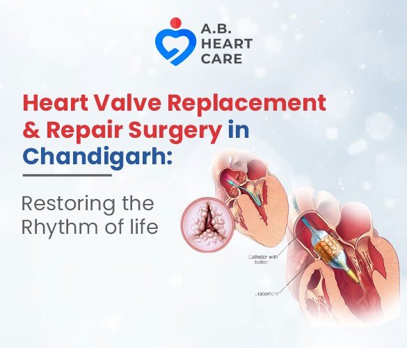 Heart Valve Replacement & Repair Surgery: Restoring the Rhythm of Life