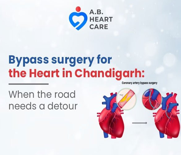 Bypass Surgery for the Heart: When the Road Needs a Detour