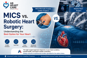 MICS vs. Robotic Heart Surgery: Understand the Best Option for you?