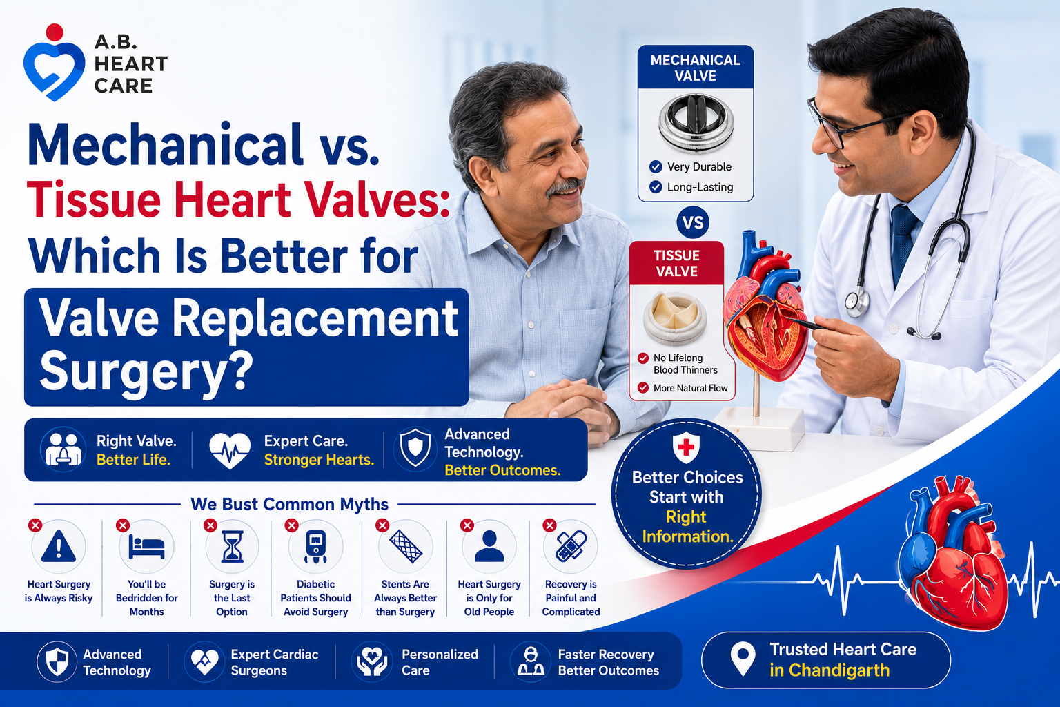 Mechanical vs. Tissue Heart Valves: Which Is Better for Valve Replacement Surgery?